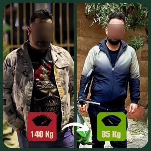 عمل لاغری اسلیو یا بای پس معده